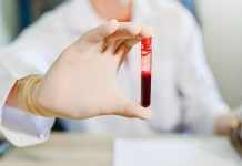 Care este diferenta dintre ser si plasma sanguina?