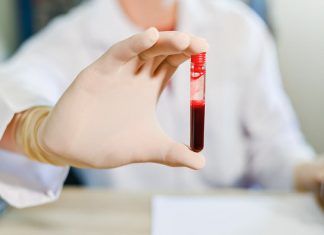 Care este diferenta dintre ser si plasma sanguina?