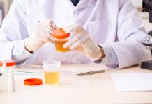 Proteine in urina: simptome, cauze si tratament